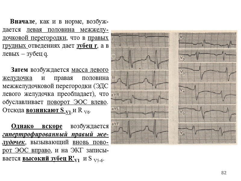 82 Вначале, как и в норме, возбуж-дается левая половина 82 Вначале, как и в норме, возбуж-дается левая половина